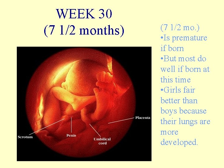 WEEK 30 (7 1/2 months) (7 1/2 mo. ) • Is premature if born