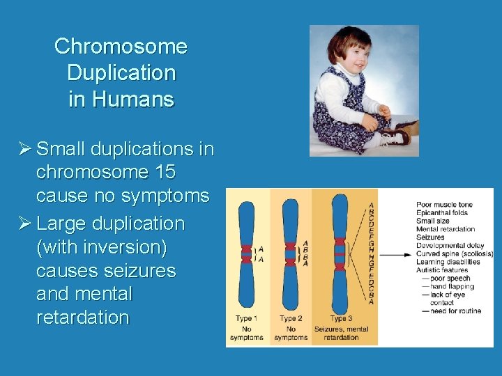 Chromosome Duplication in Humans Ø Small duplications in chromosome 15 cause no symptoms Ø
