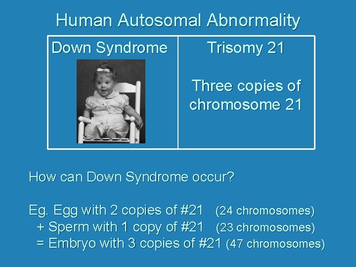 Human Autosomal Abnormality Down Syndrome Trisomy 21 Three copies of chromosome 21 How can