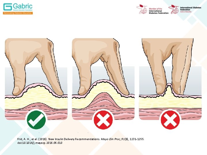 Frid, A. H. , et al. (2016). New Insulin Delivery Recommendations. Mayo Clin Proc,