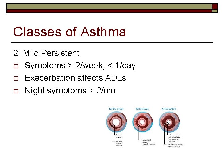 Classes of Asthma 2. Mild Persistent o Symptoms > 2/week, < 1/day o Exacerbation