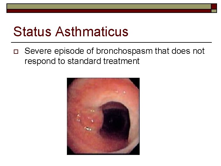 Status Asthmaticus o Severe episode of bronchospasm that does not respond to standard treatment