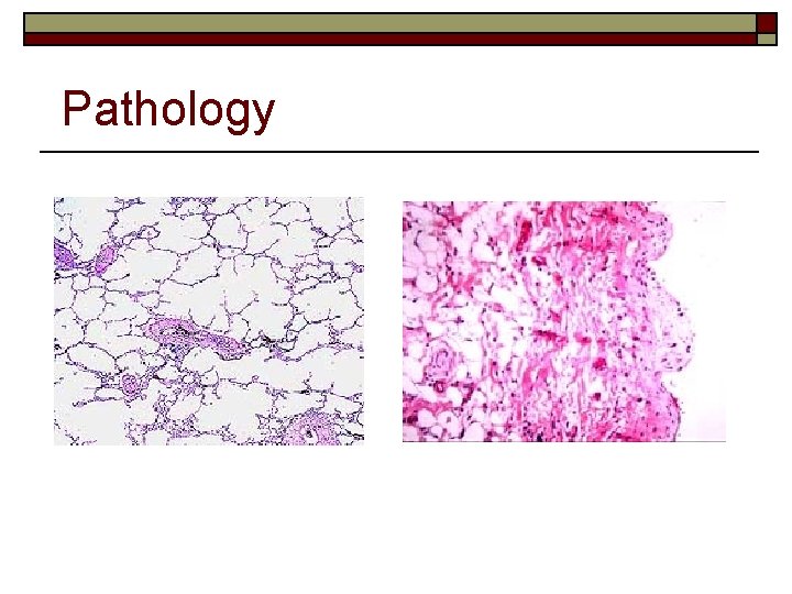 Pathology 