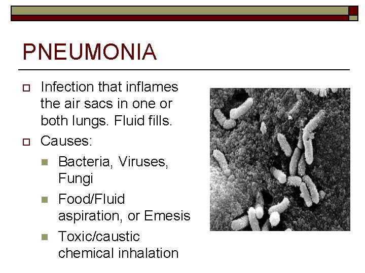 PNEUMONIA o o Infection that inflames the air sacs in one or both lungs.