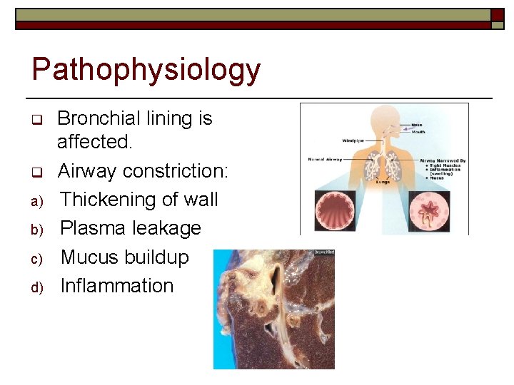 Pathophysiology q q a) b) c) d) Bronchial lining is affected. Airway constriction: Thickening