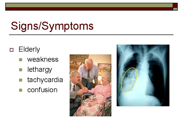 Signs/Symptoms o Elderly n weakness n lethargy n tachycardia n confusion 