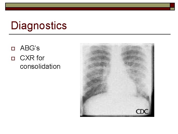 Diagnostics o o ABG’s CXR for consolidation 
