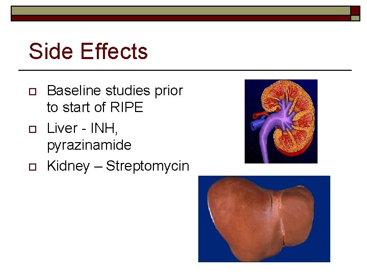 Side Effects o o o Baseline studies prior to start of RIPE Liver -