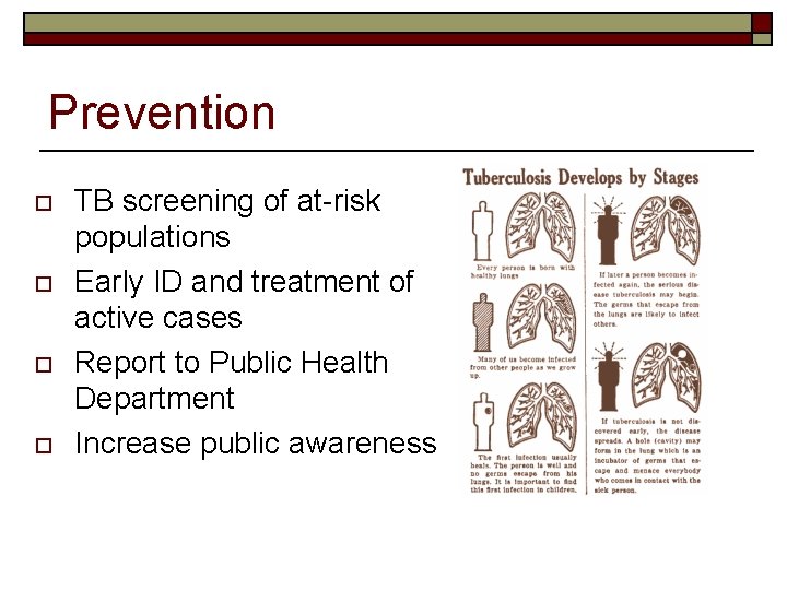 Prevention o o TB screening of at-risk populations Early ID and treatment of active