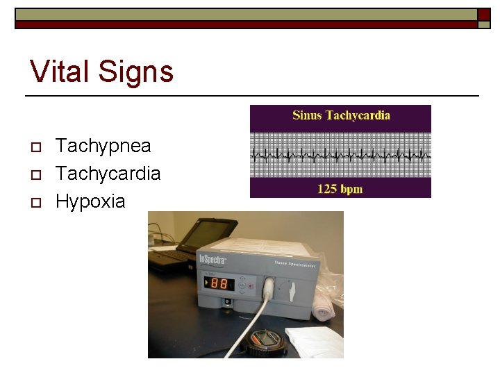 Vital Signs o o o Tachypnea Tachycardia Hypoxia 