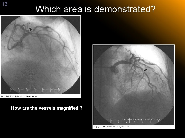 13 Which area is demonstrated? How are the vessels magnified ? 