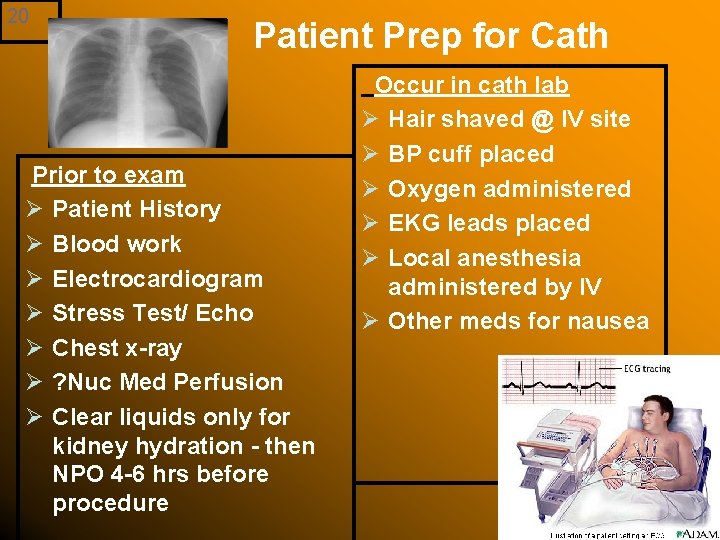 20 Patient Prep for Cath Prior to exam Ø Patient History Ø Blood work