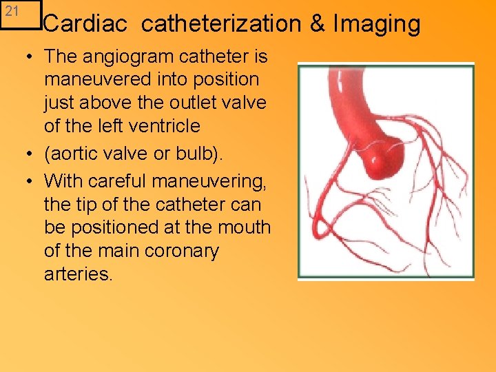 21 Cardiac catheterization & Imaging • The angiogram catheter is maneuvered into position just