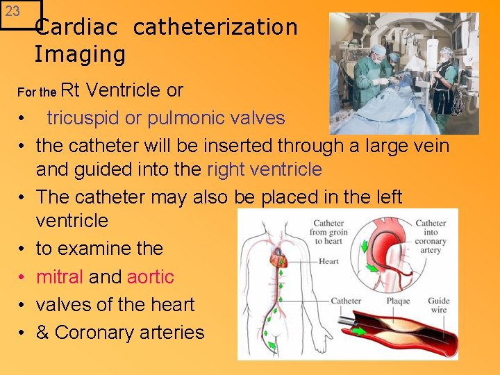 23 Cardiac catheterization Imaging For the Rt • • Ventricle or tricuspid or pulmonic