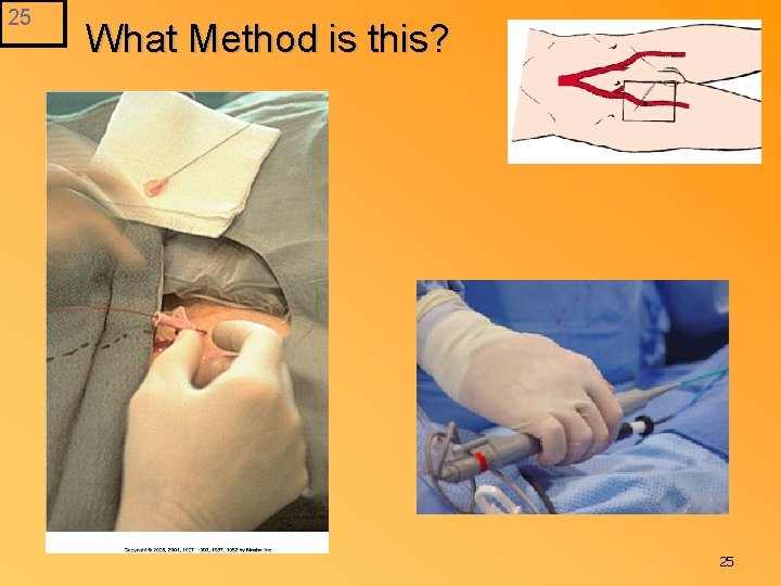 25 What Method is this? 25 