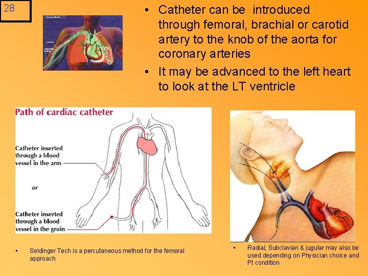  • Catheter can be introduced through femoral, brachial or carotid artery to the