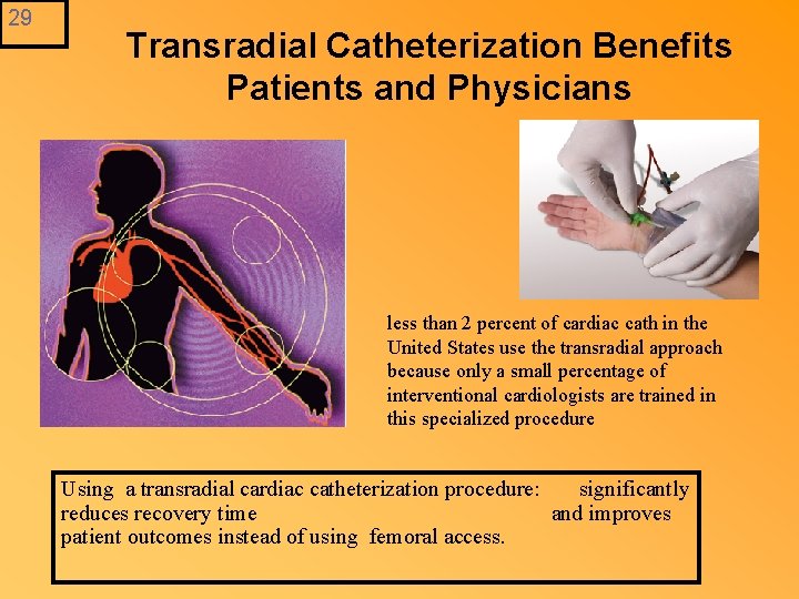 29 Transradial Catheterization Benefits Patients and Physicians less than 2 percent of cardiac cath