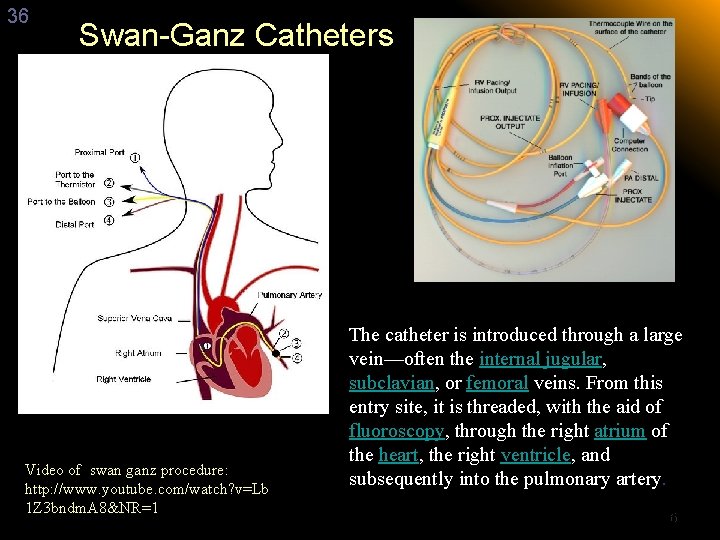 36 Swan-Ganz Catheters Video of swan ganz procedure: http: //www. youtube. com/watch? v=Lb 1