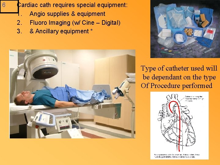 6 Cardiac cath requires special equipment: 1. Angio supplies & equipment 2. Fluoro Imaging