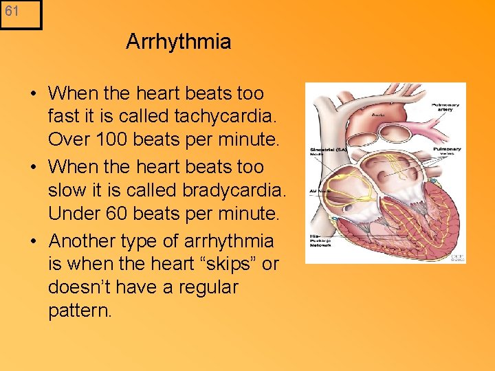 61 Arrhythmia • When the heart beats too fast it is called tachycardia. Over