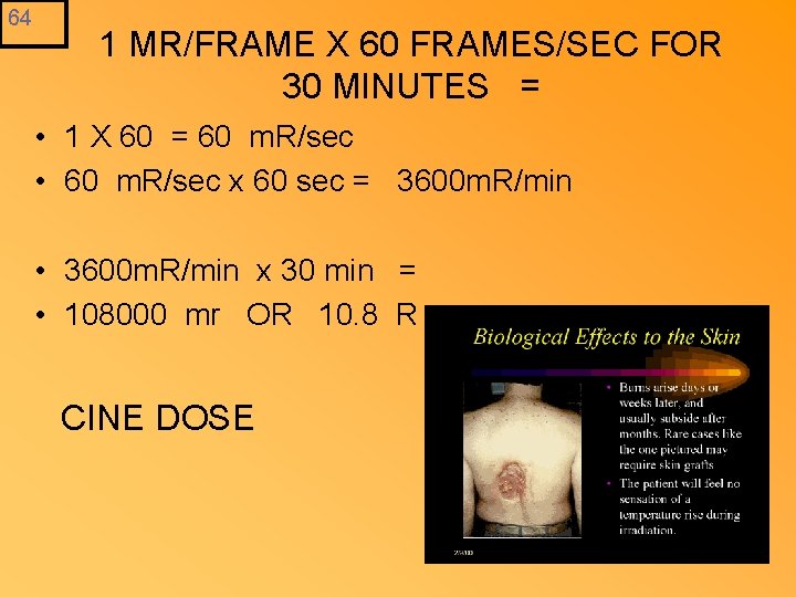 64 1 MR/FRAME X 60 FRAMES/SEC FOR 30 MINUTES = • 1 X 60