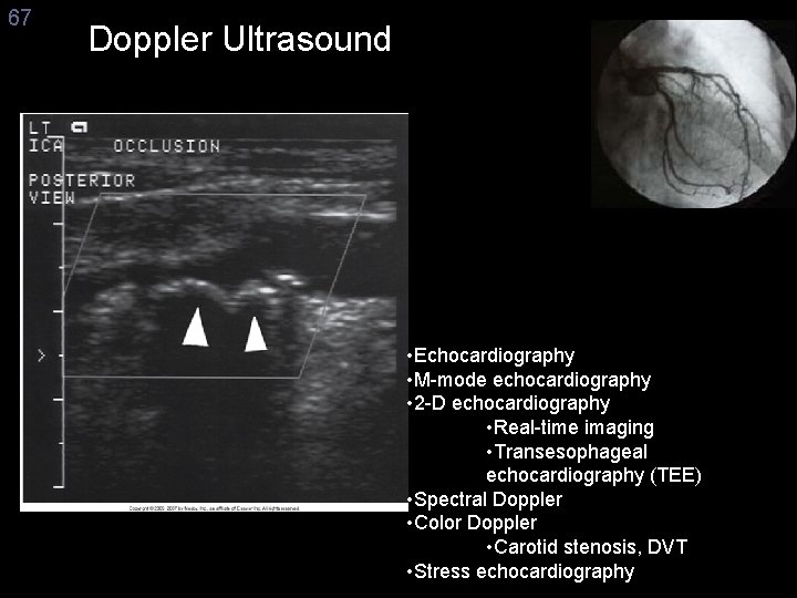67 Doppler Ultrasound • Echocardiography • M-mode echocardiography • 2 -D echocardiography • Real-time