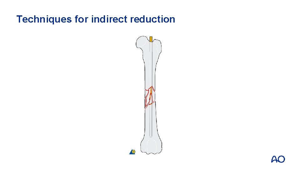 Techniques for indirect reduction 
