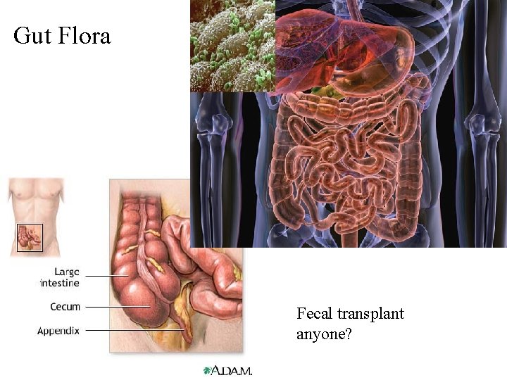 Gut Flora Fecal transplant anyone? 