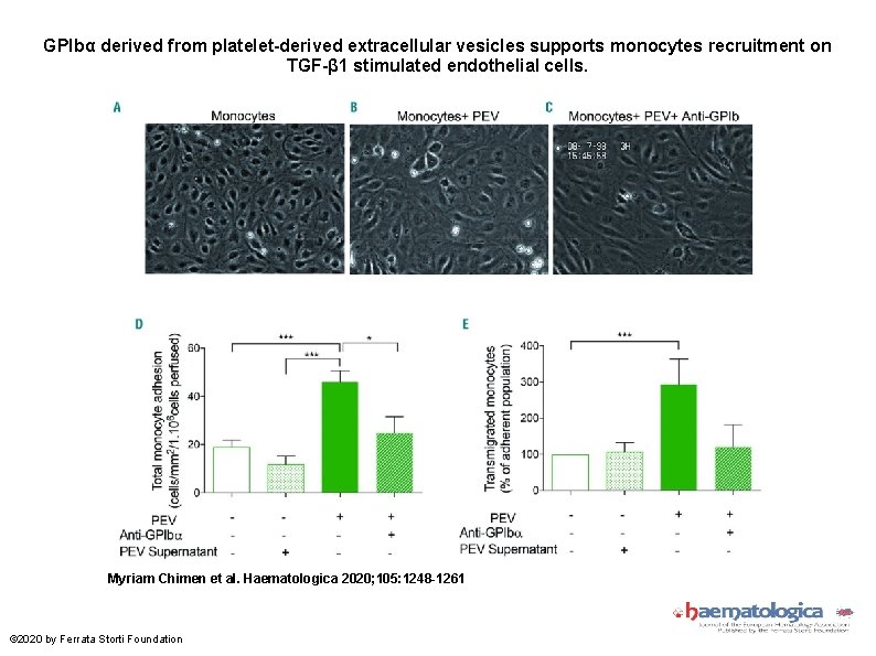 GPIbα derived from platelet-derived extracellular vesicles supports monocytes recruitment on TGF-β 1 stimulated endothelial