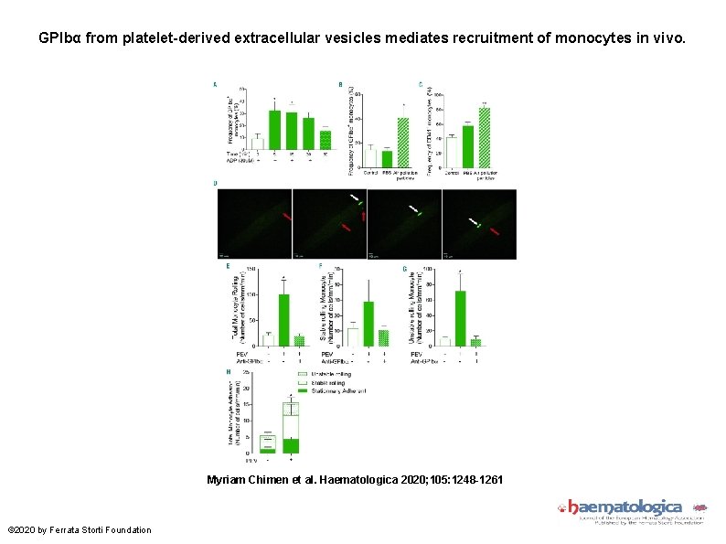 GPIbα from platelet-derived extracellular vesicles mediates recruitment of monocytes in vivo. Myriam Chimen et