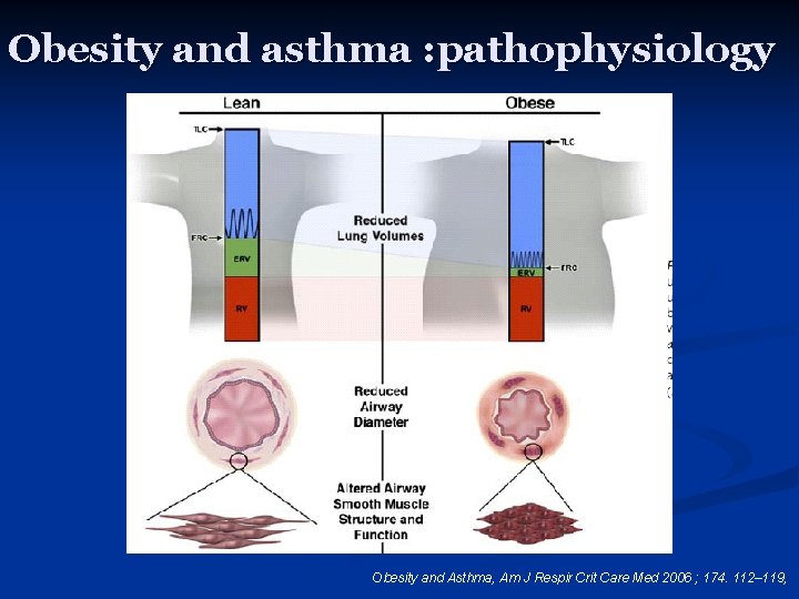 Obesity and asthma : pathophysiology Obesity and Asthma, Am J Respir Crit Care Med
