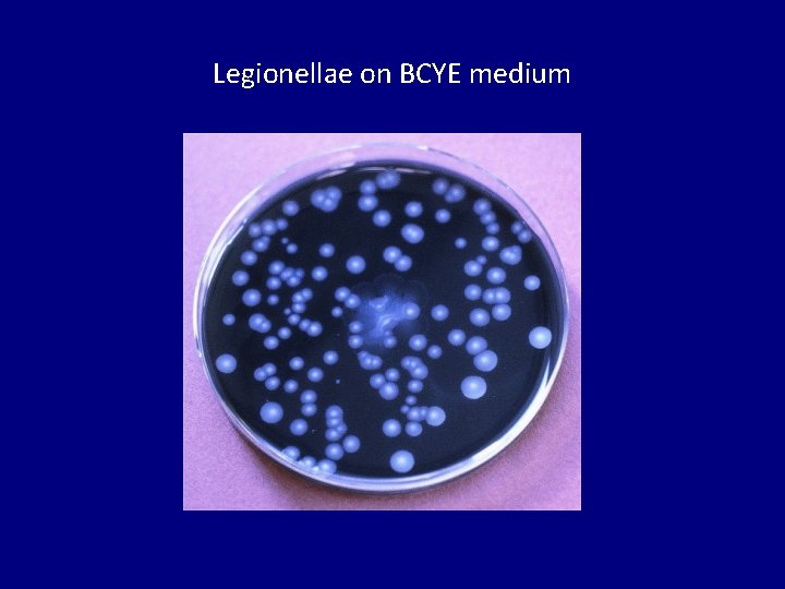 Legionellae on BCYE medium 