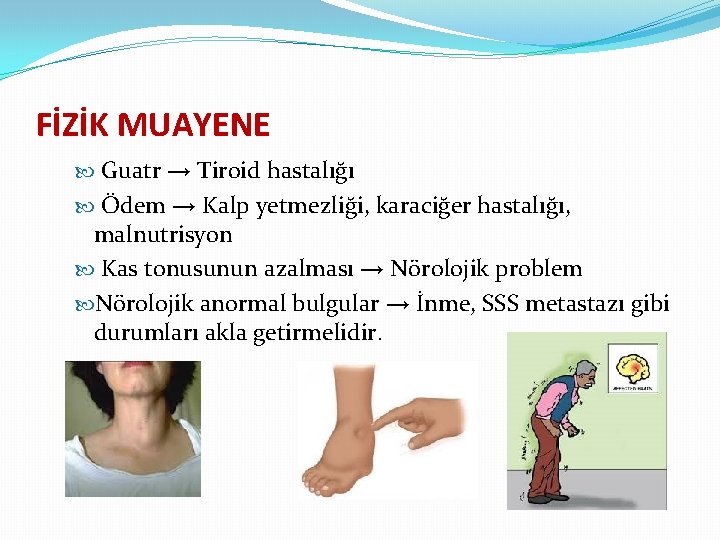 FİZİK MUAYENE Guatr → Tiroid hastalığı Ödem → Kalp yetmezliği, karaciğer hastalığı, malnutrisyon Kas