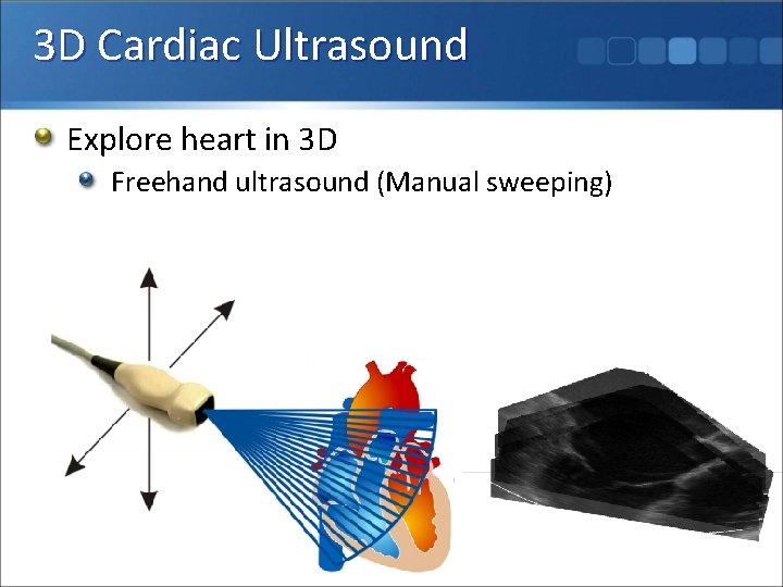 3 D Cardiac Ultrasound Explore heart in 3 D Freehand ultrasound (Manual sweeping) 