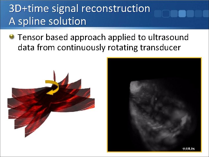 3 D+time signal reconstruction A spline solution Tensor based approach applied to ultrasound data