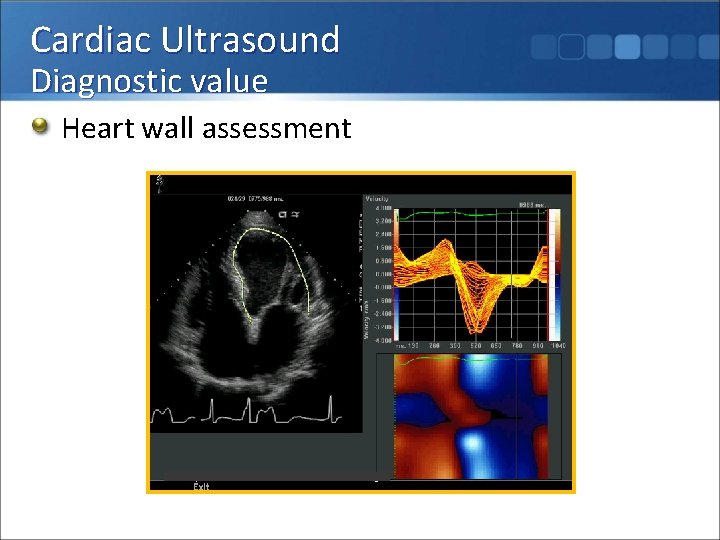 Cardiac Ultrasound Diagnostic value Heart wall assessment 