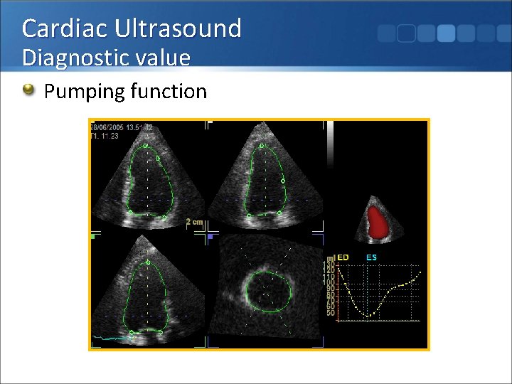 Cardiac Ultrasound Diagnostic value Pumping function 