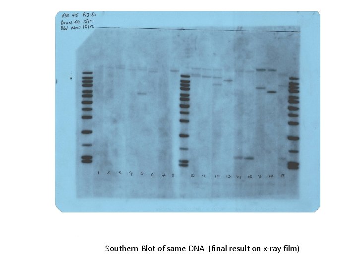 Southern Blot of same DNA (final result on x-ray film) 