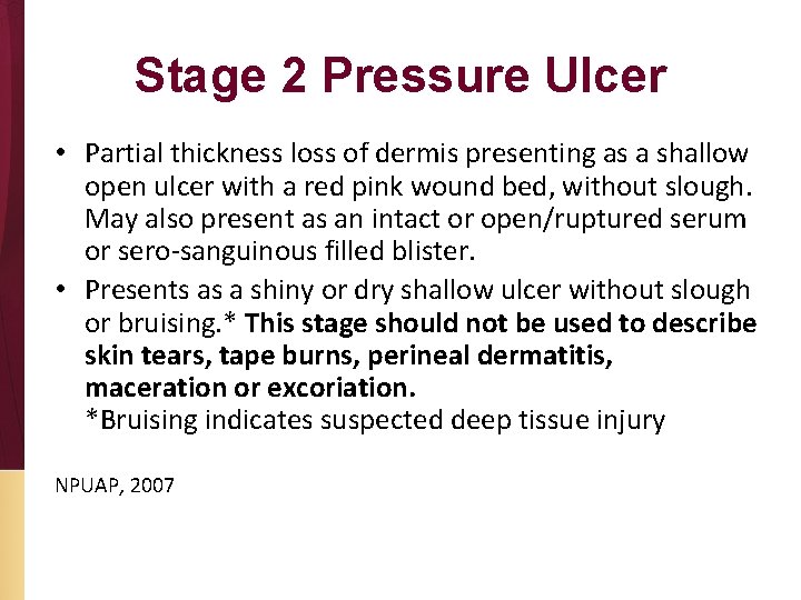 Stage 2 Pressure Ulcer • Partial thickness loss of dermis presenting as a shallow