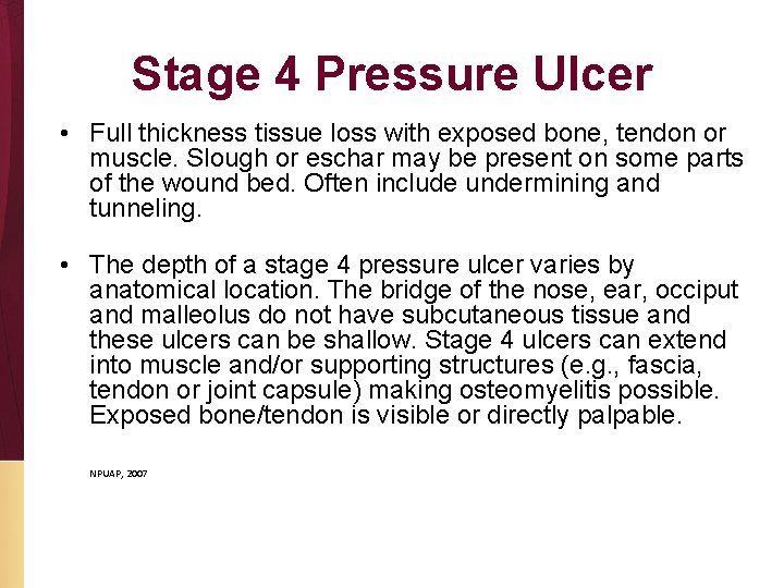 Stage 4 Pressure Ulcer • Full thickness tissue loss with exposed bone, tendon or