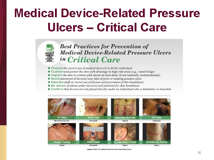 Medical Device-Related Pressure Ulcers – Critical Care 26 