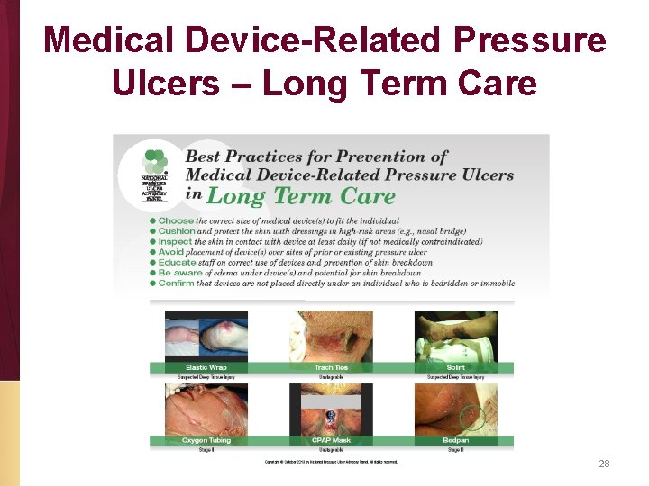 Medical Device-Related Pressure Ulcers – Long Term Care 28 
