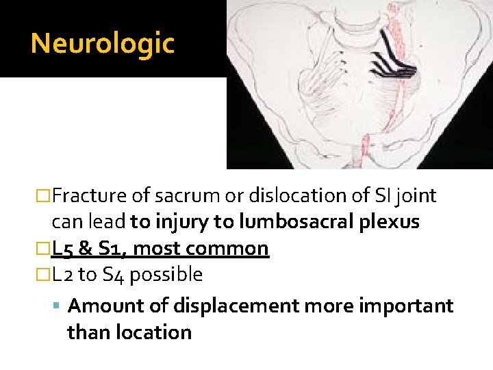 Neurologic �Fracture of sacrum or dislocation of SI joint can lead to injury to