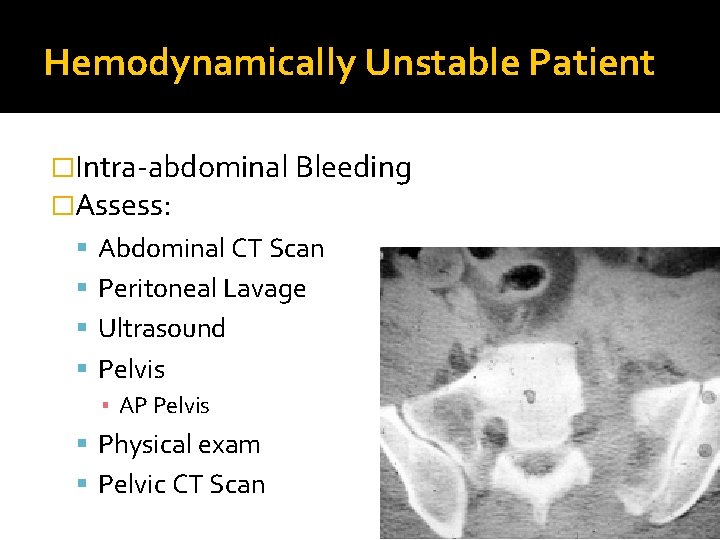 Hemodynamically Unstable Patient �Intra-abdominal Bleeding �Assess: Abdominal CT Scan Peritoneal Lavage Ultrasound Pelvis ▪