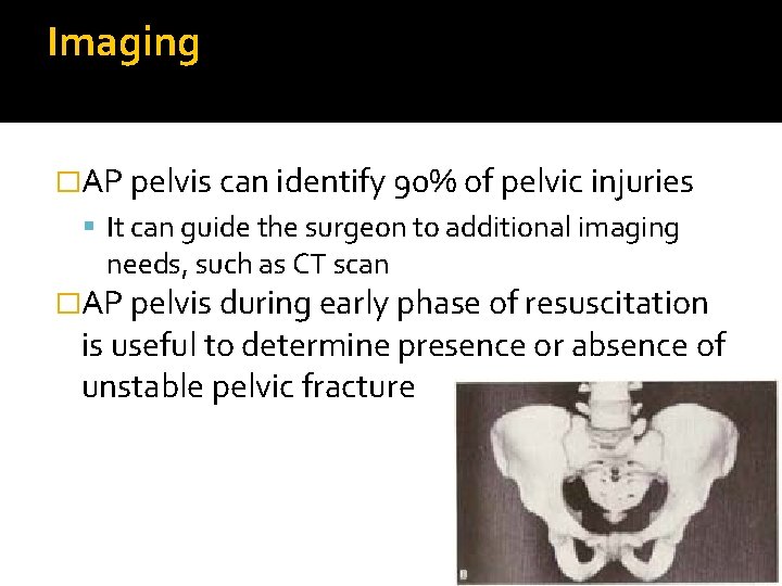 Imaging �AP pelvis can identify 90% of pelvic injuries It can guide the surgeon