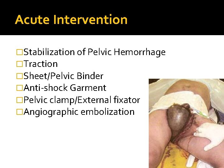 Acute Intervention �Stabilization of Pelvic Hemorrhage �Traction �Sheet/Pelvic Binder �Anti-shock Garment �Pelvic clamp/External fixator