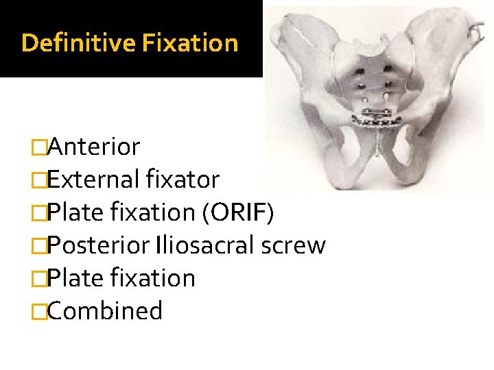 Definitive Fixation �Anterior �External fixator �Plate fixation (ORIF) �Posterior Iliosacral screw �Plate fixation �Combined