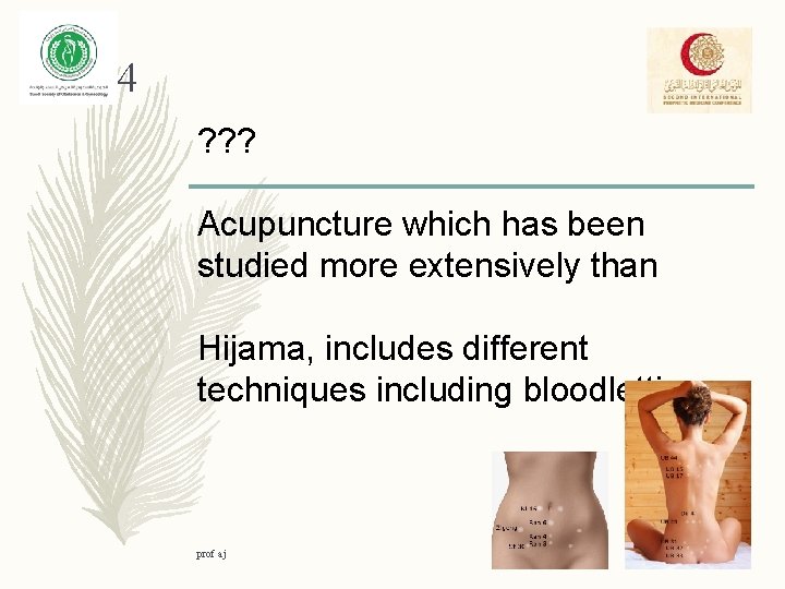 4 ? ? ? Acupuncture which has been studied more extensively than Hijama, includes