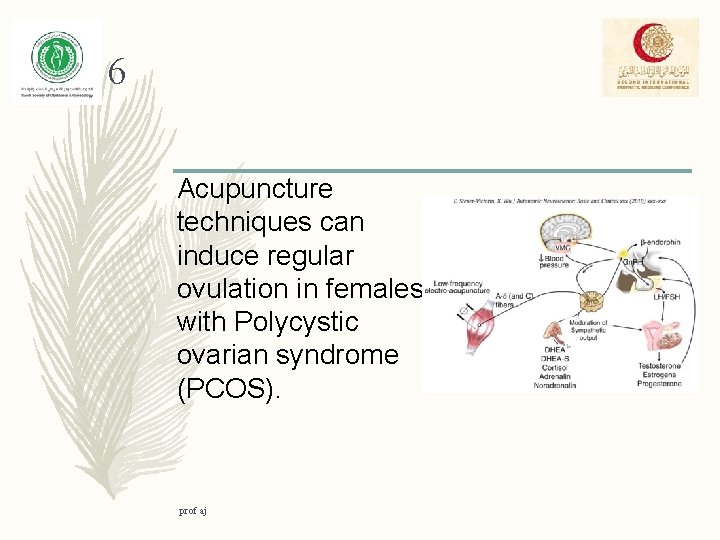 6 Acupuncture techniques can induce regular ovulation in females with Polycystic ovarian syndrome (PCOS).