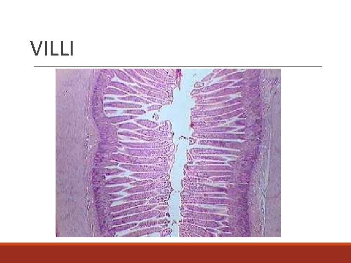 VILLI 